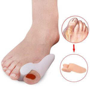 Soft Bunion Splint